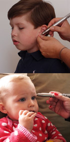 Kinderlaserakupunktur